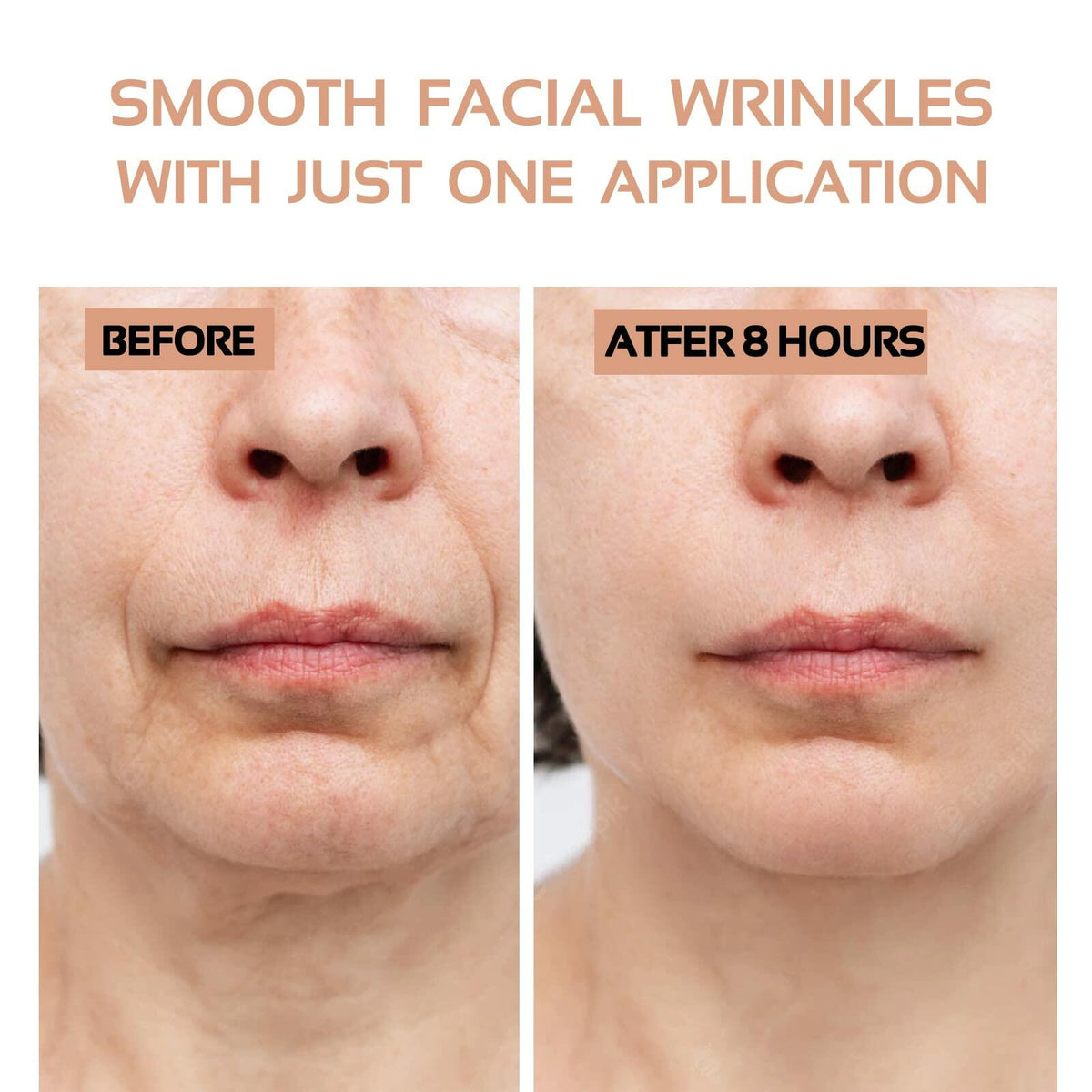 ENROSLU Face Wrinkle Patches 256Pcs Clear Reusable Anti-Wrinkle Treatment