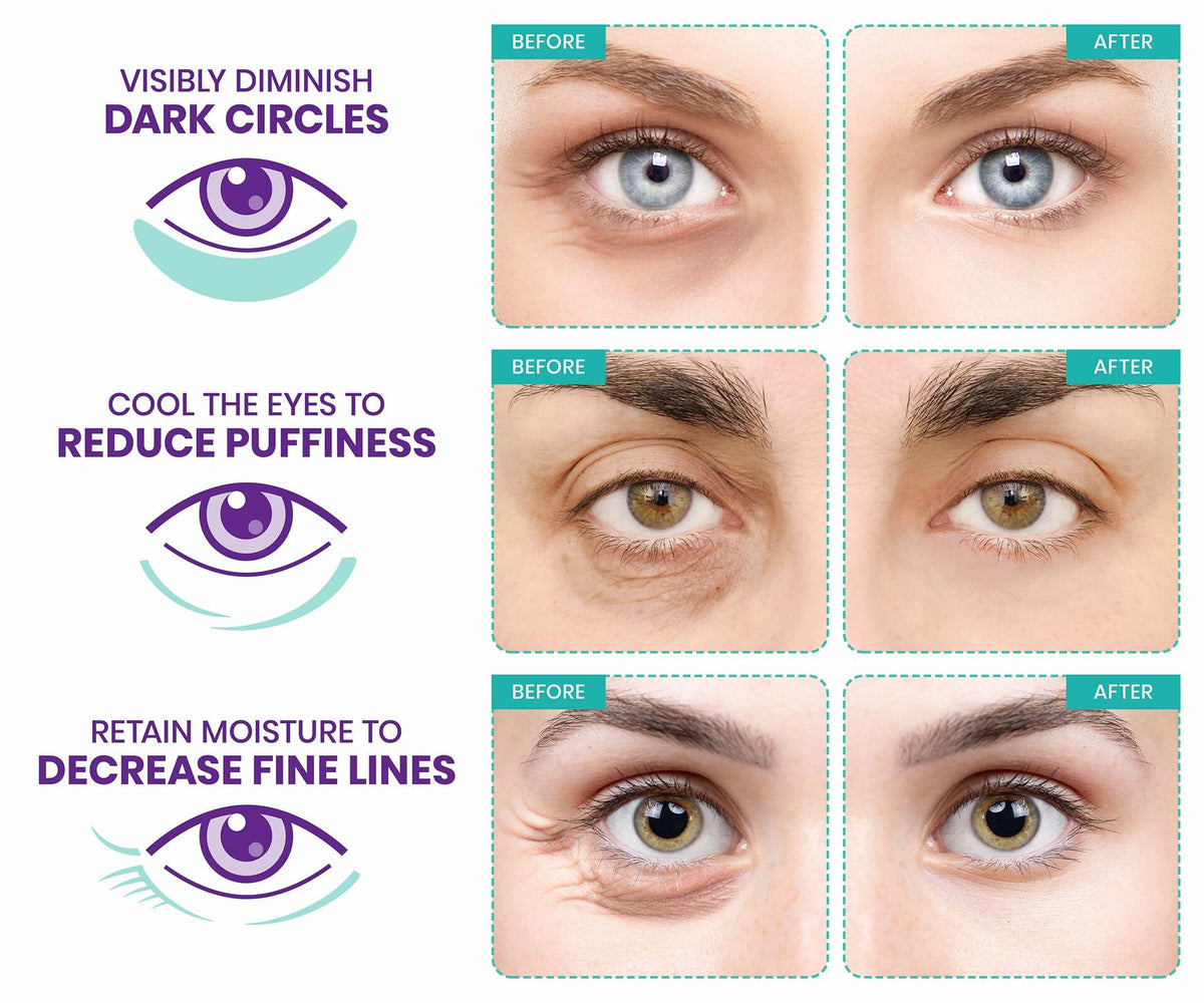 Stylia Under Eye Patches Marine Collagen Retinol Vitamin C Hyaluronic 6 Pairs
