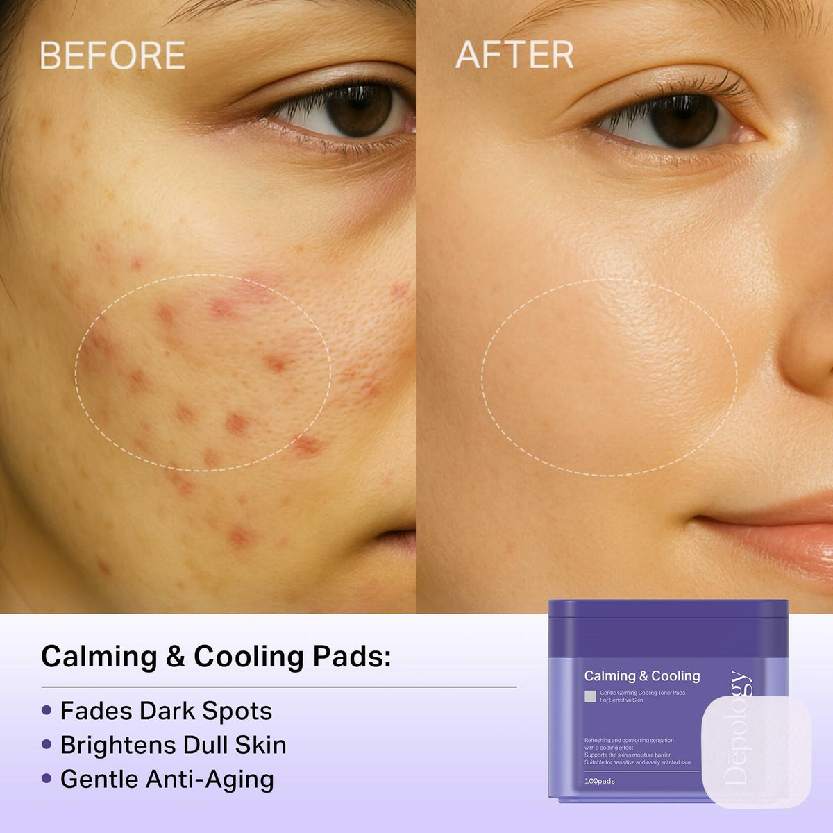 BestBy02/26 depology Blemish & Tone Toner Pads 100 Pads Sensitive Skin